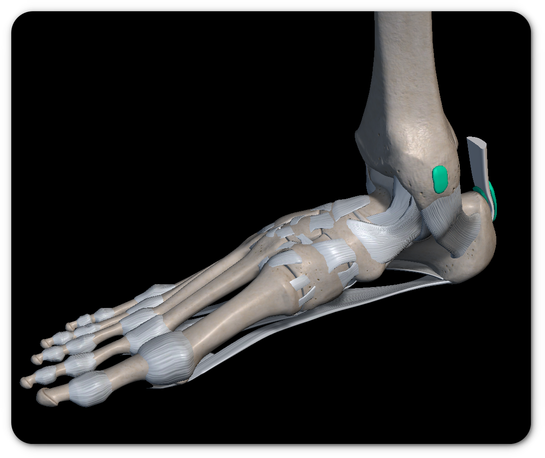 발목 염좌 증상