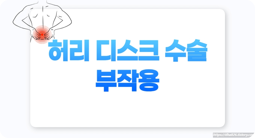허리 디스크 수술 부작용