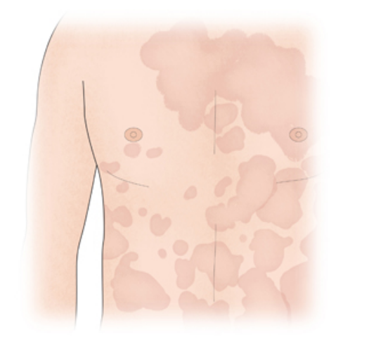 식염수 코세척 부작용