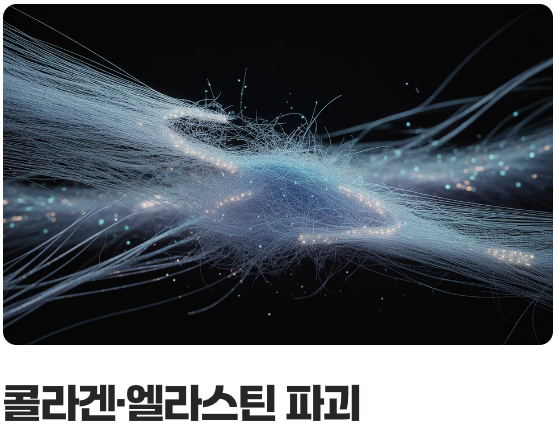 튼살, 도대체 왜 생기는 걸까?