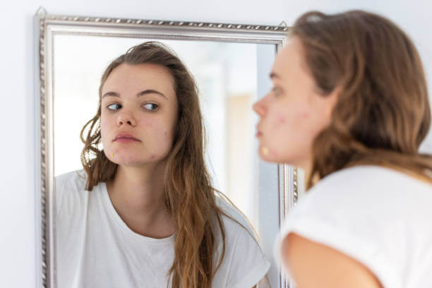 여드름 흉터와 모공 요철 관리? 매끈한 피부 만드는 법!