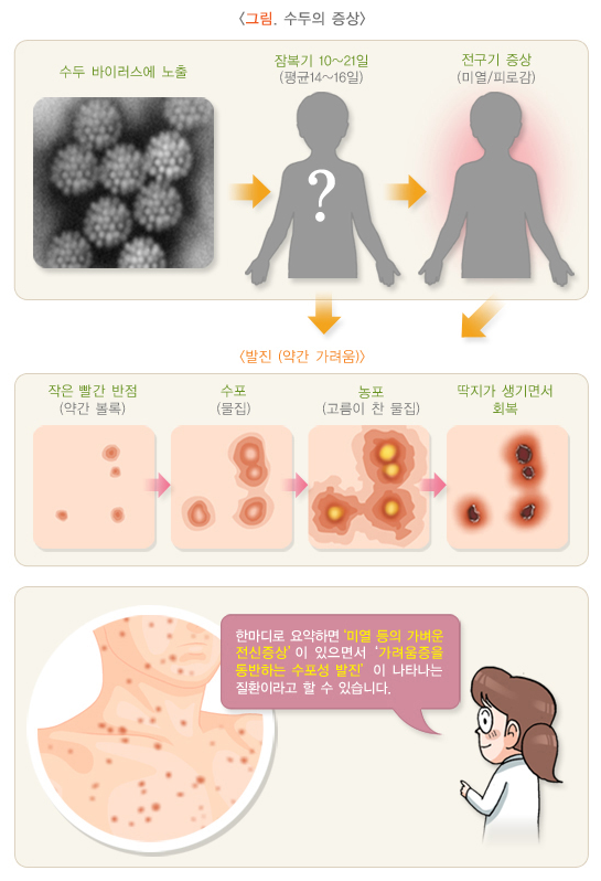 수두의 증상