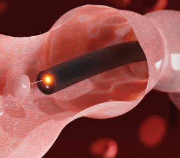 대장내시경 용종제거 후 식사 음주 주의사항 알아보기