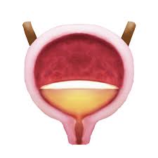 역류성 식도염