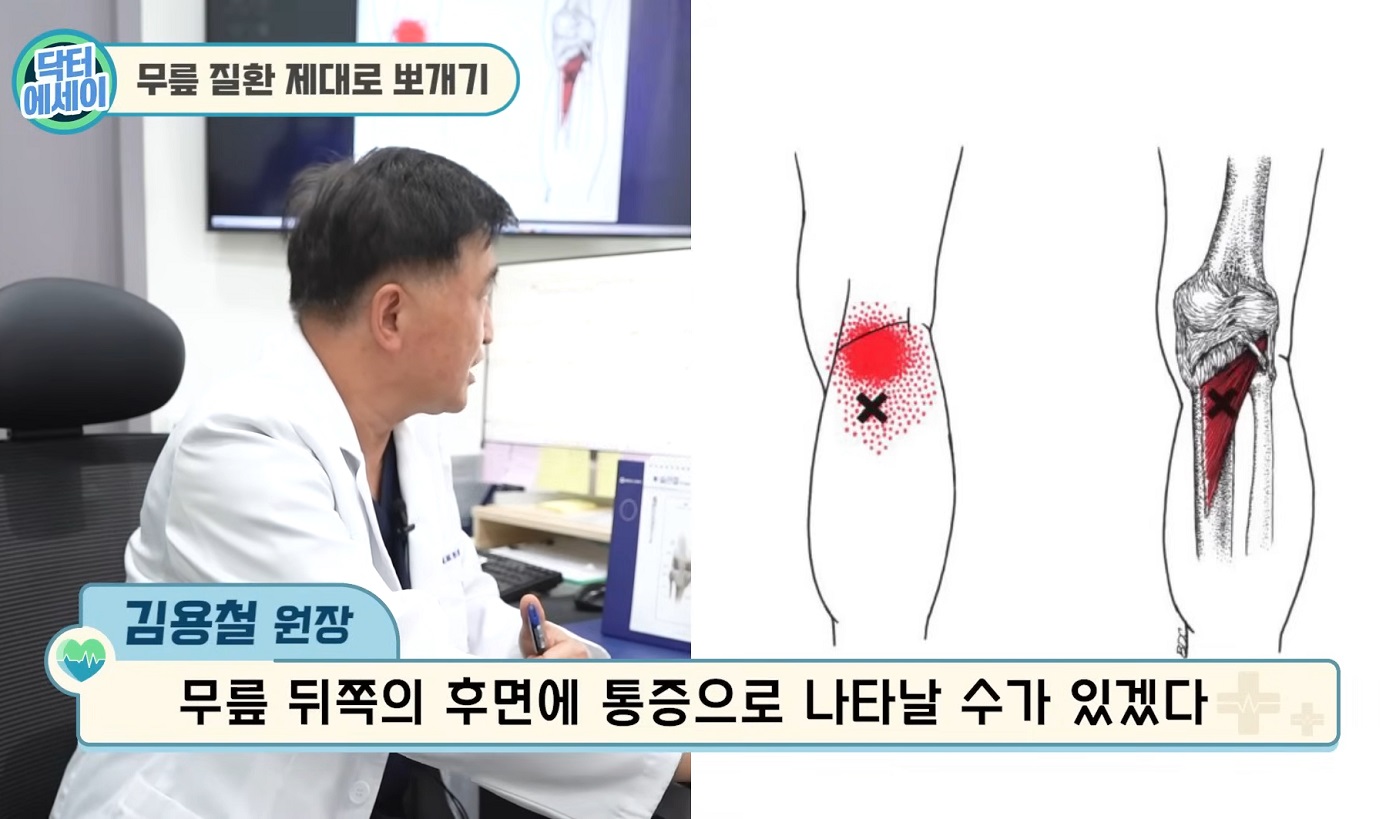 -퇴행성-관절염-김성환-교수