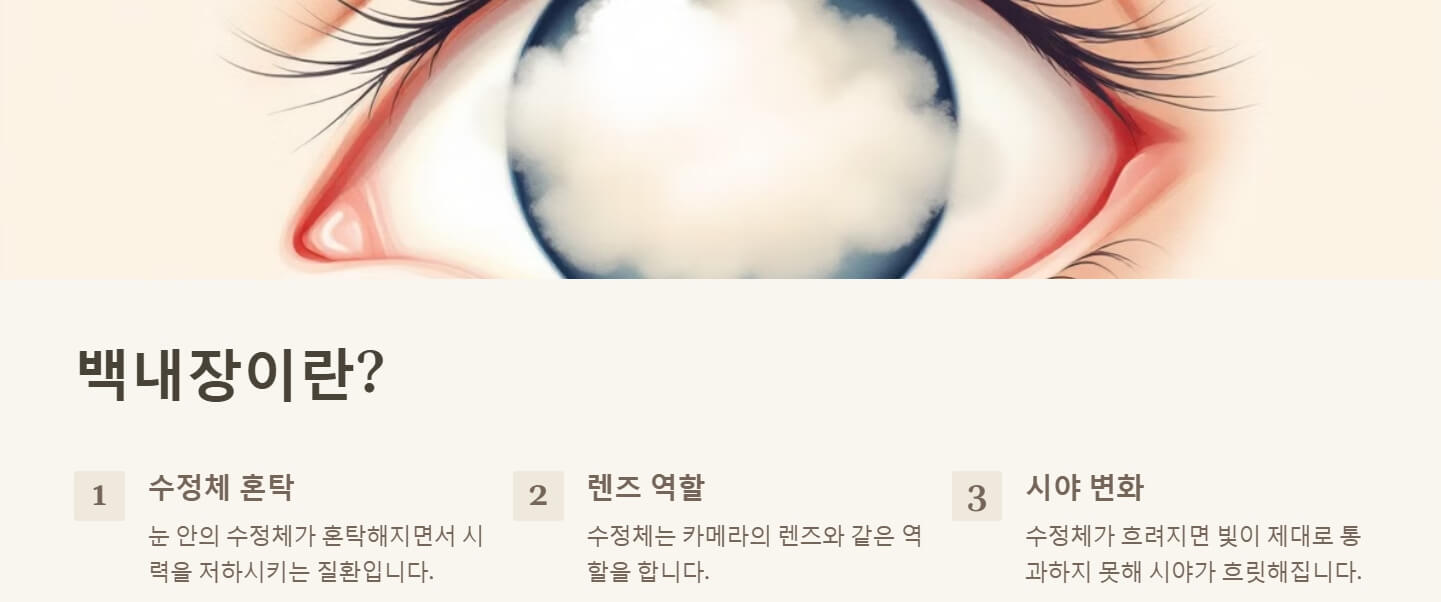 백내장 원인과 증상