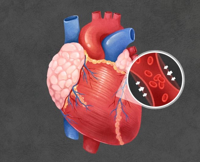 심혈관 질환 전조증상