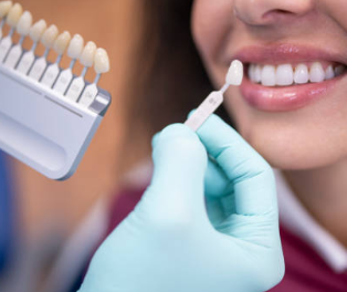 오스템 임플란트 가격, 종류