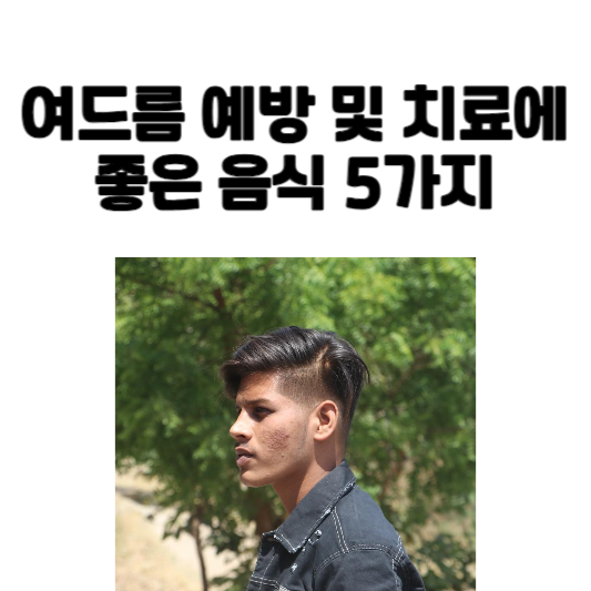 여드름 예방 및 치료에 좋은 음식