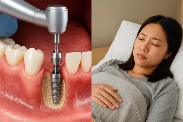 임플란트 시술 단계별 과정 안내