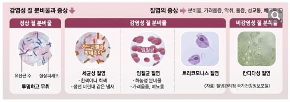 질염의증상