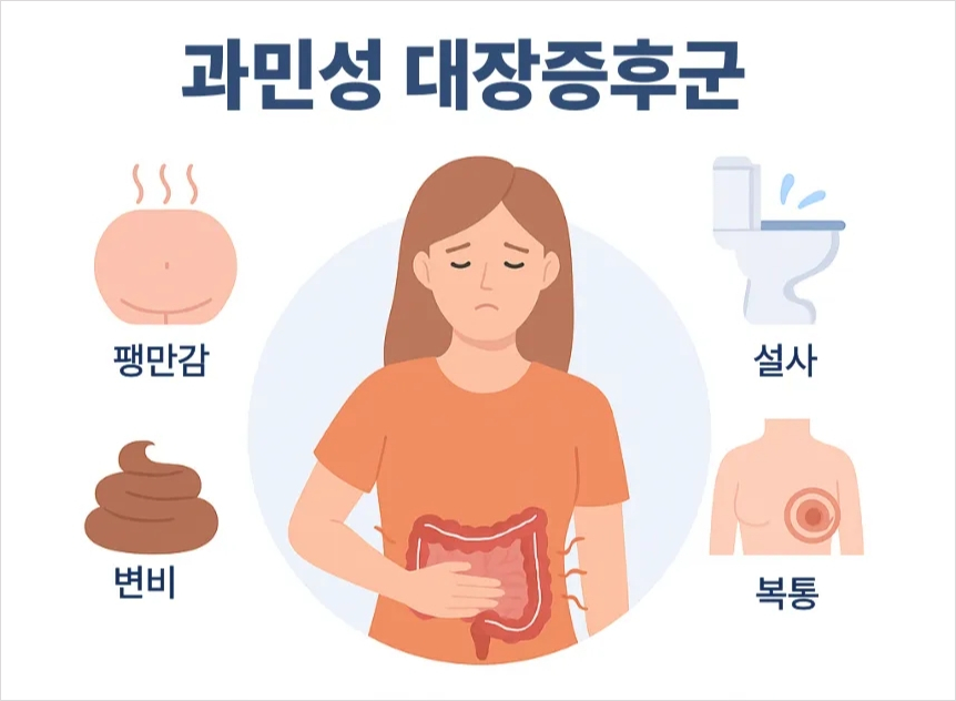 과민성 대장증후군