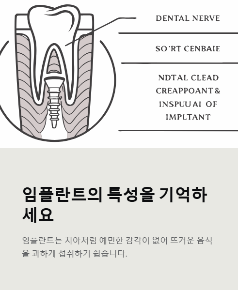 임플란트의 특성을 기억하세요