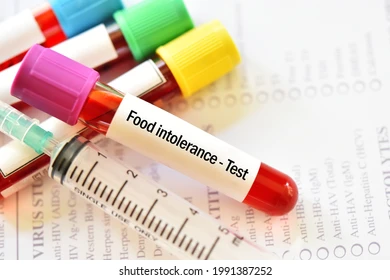 음식물 과민증 검사 원인, 증상, 검사 방법 및 식단 관리 가이드