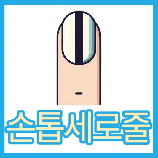 흑색종 손톱에검은세로줄 원인 증상 치료