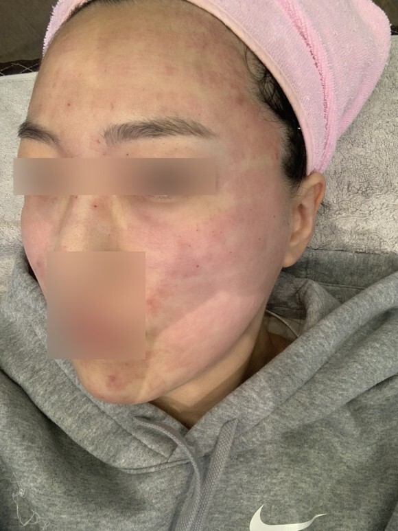 크라이오셀 후기