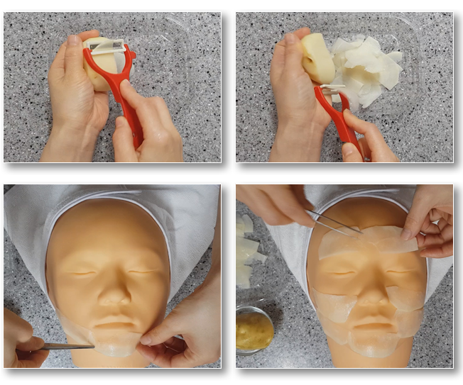 감자 마스크팩 시술과정