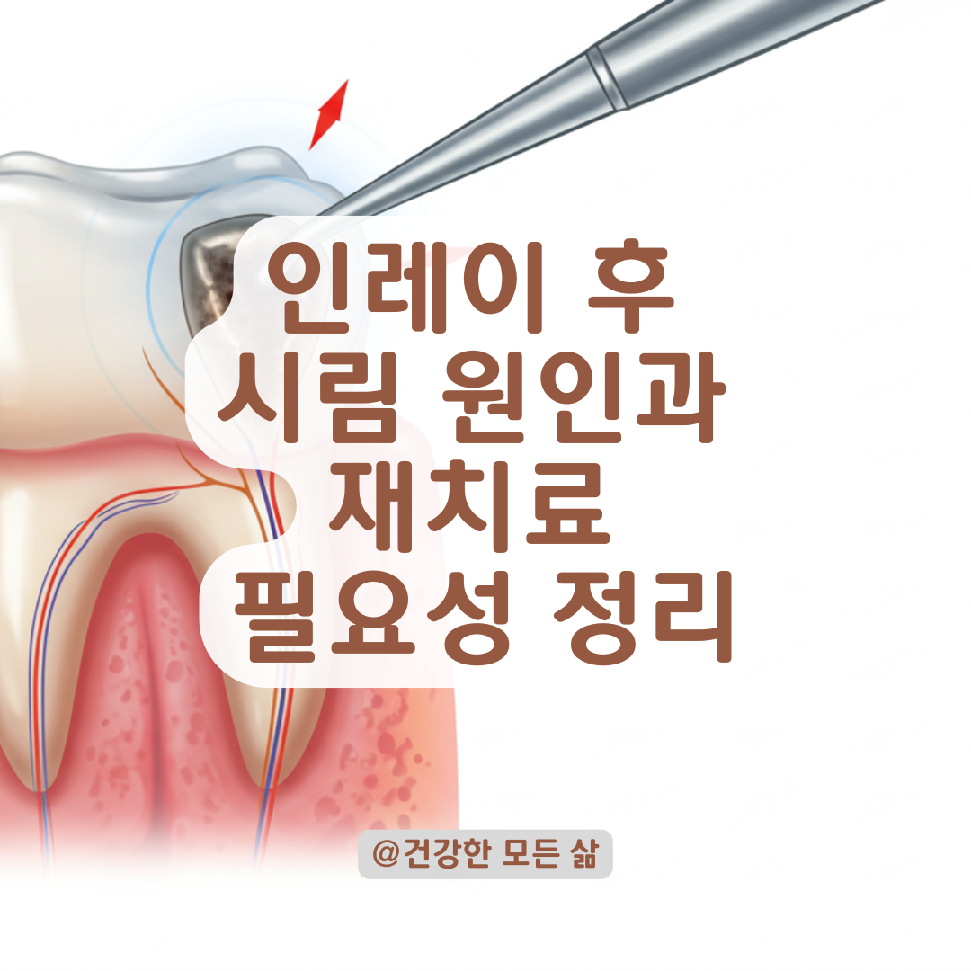 오래된 인레이에서 시림 증상이 나타난다면? 원인부터 재치료 필요 여부까지 정리.