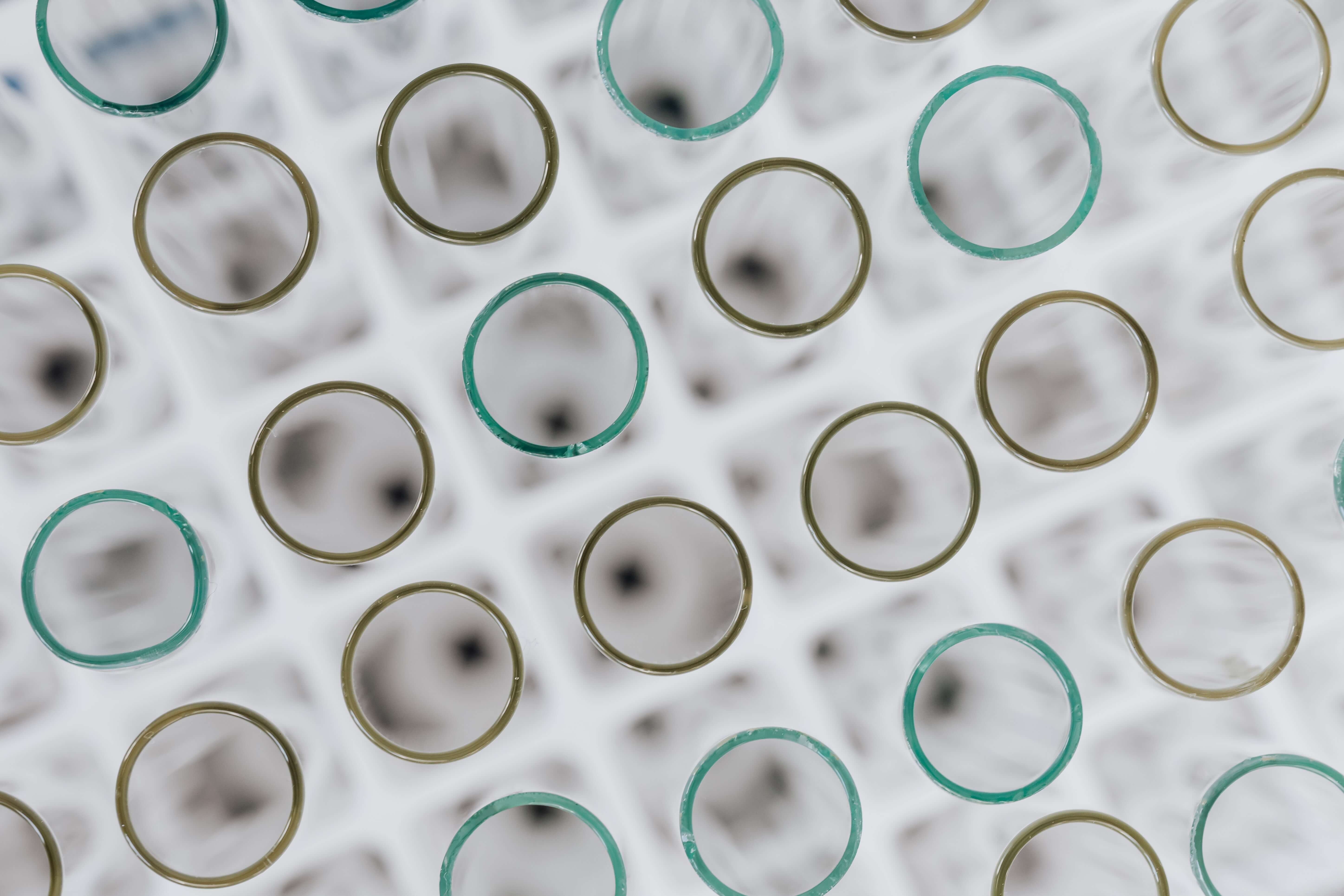 우울증 세로토닌