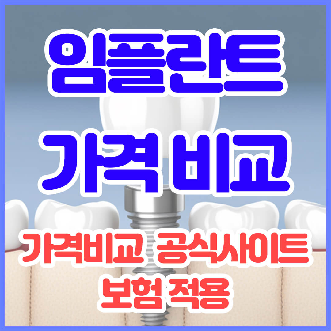 임플란트 가격비교 사이트 추천