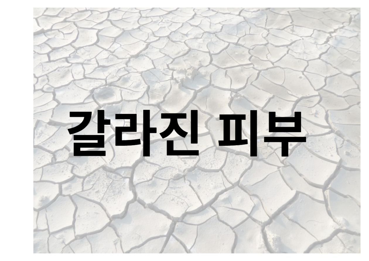 튼살