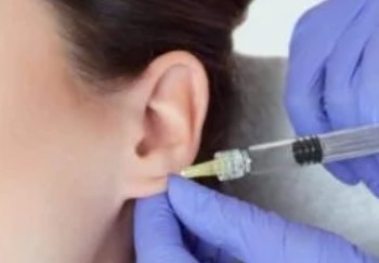 [귀필러] 요정귀 필러 효과, 부작용, 주의할 점