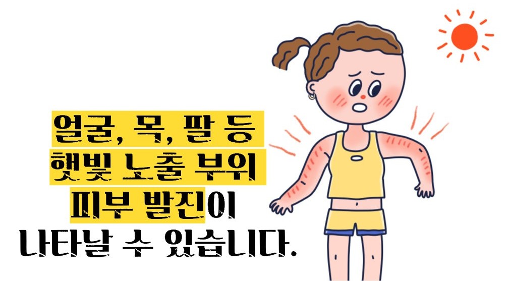 루푸스병 이란