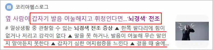 뇌경색 전조증상 기사 이미지