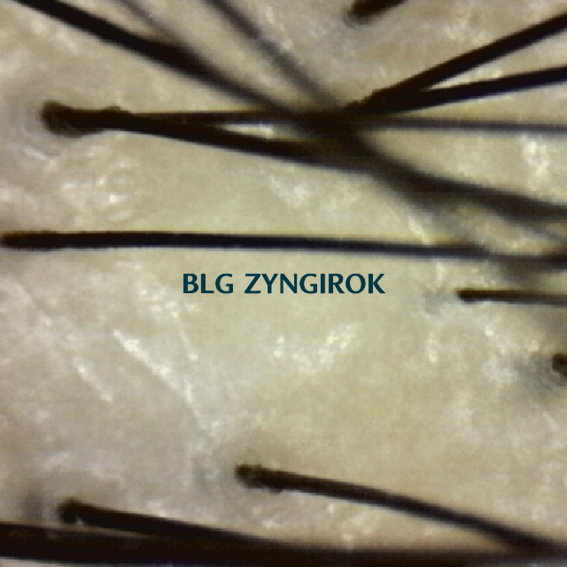 탈모 극복 프로젝트 - 탈모약 복용 33주차 정수리 두피사진이다.