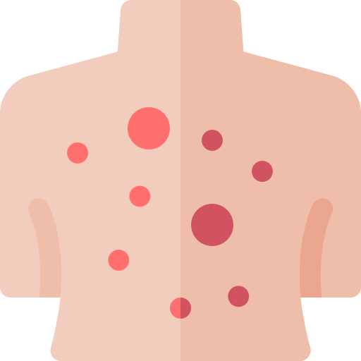 피부발진 종류 피부발진 원인 피부 붉은발진