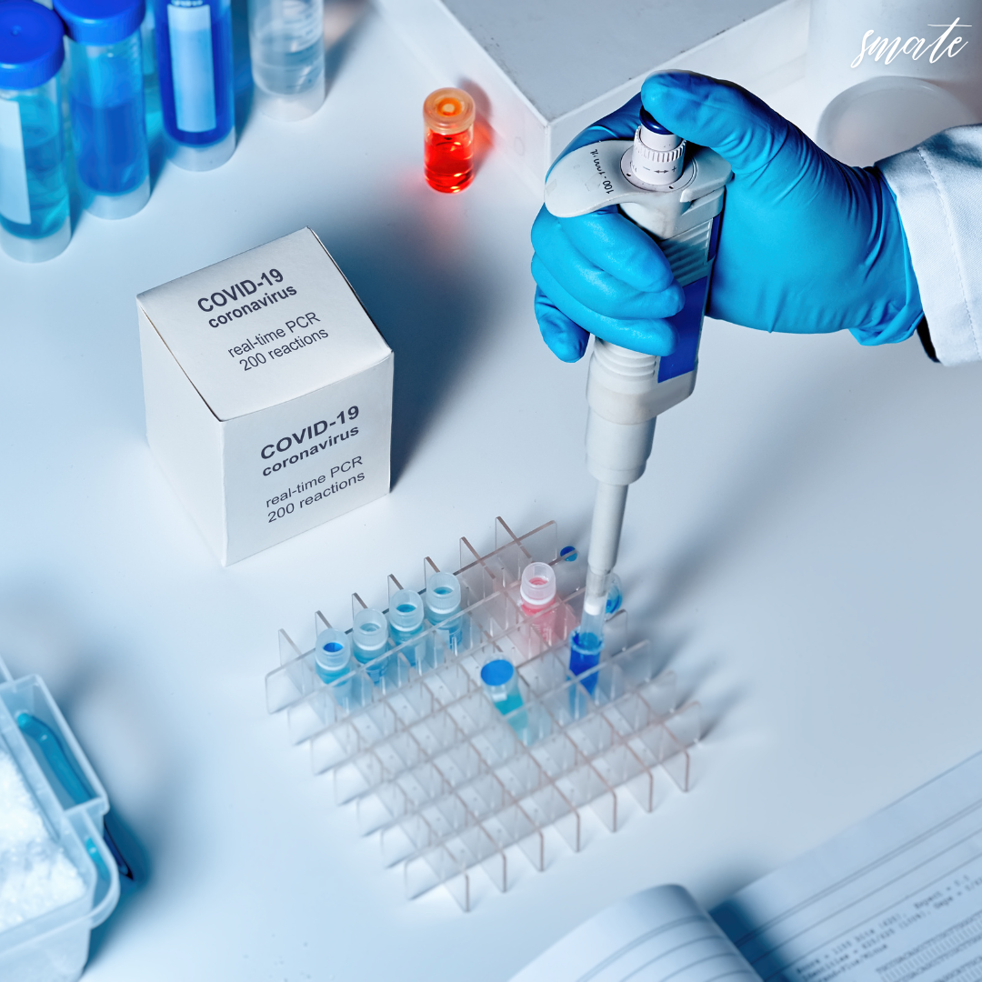 테스트를 수행하는 실험실에서 테스트 키트를 사용합니다