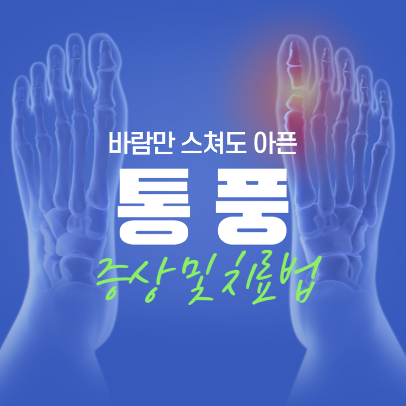 통풍 증상 및 치료법