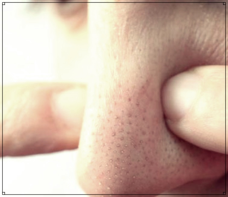 소극성속모증: 원인, 증상, 치료법 완벽 가이드