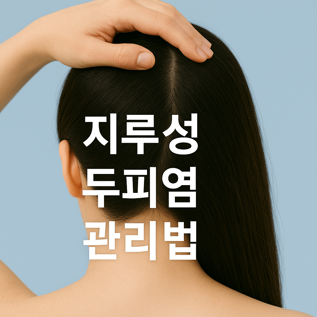지루성 두피염 완전정복