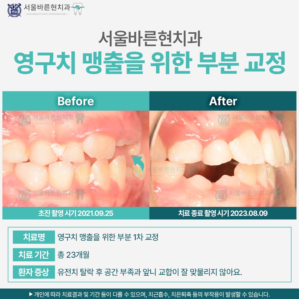 부산교정치과