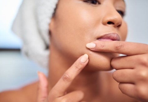 피부 트러블 진정 시키는 방법