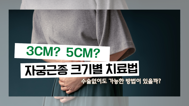 3cm? 5cm? 자궁근종 크기 별 치료법