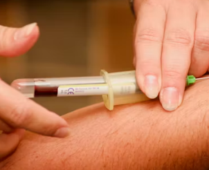 담석증 치료방법 진단기준 합병증