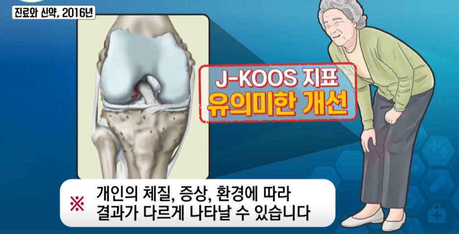 프로테오글리칸 효능