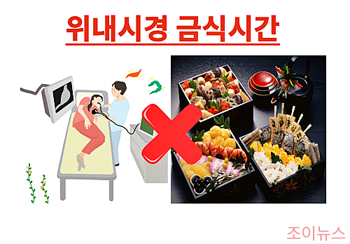 위내시경 전 금식시간