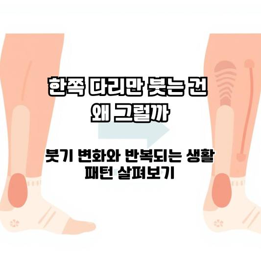 한쪽 다리 붓기 변화를 조용히 살펴보는 중년 일상 장면