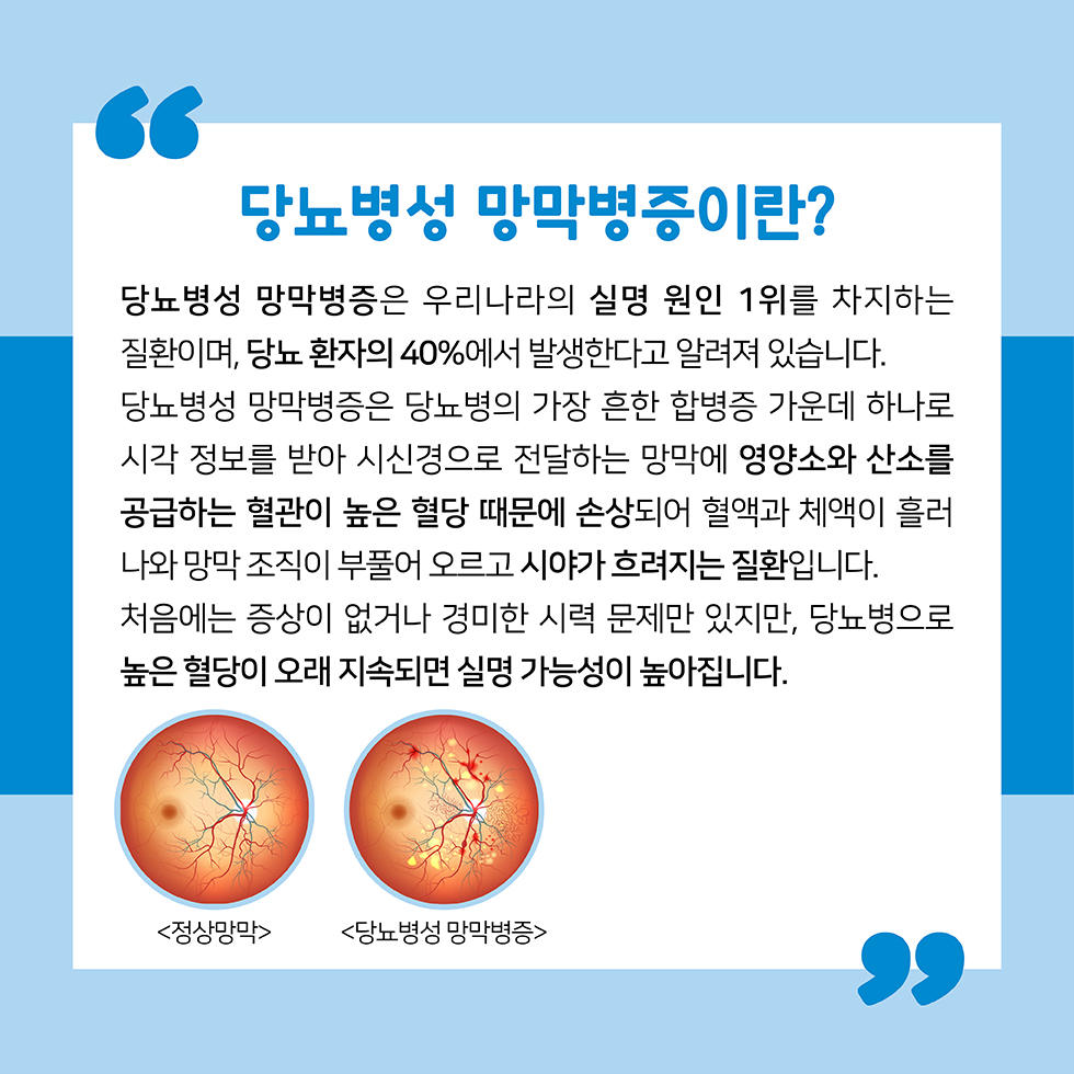 당뇨병 원인