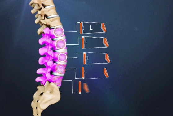 요추 염좌 통증 원인 증상 4가지 및 요추부 염좌 회복기간 및 스트레칭