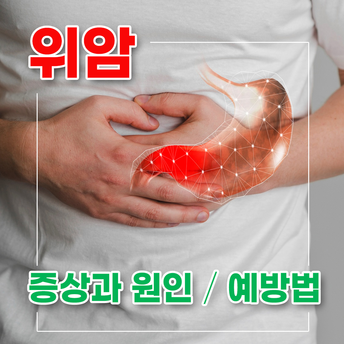 위암 대표 이미지