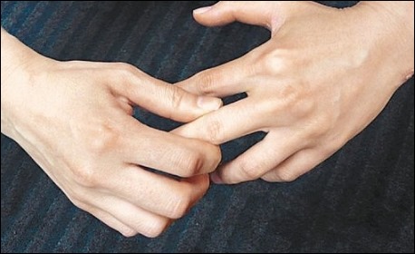 손가락 마디 통증 5