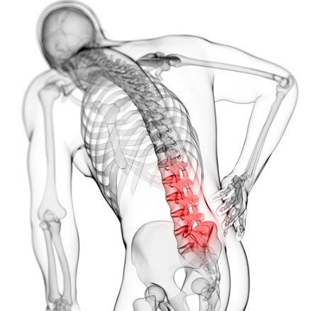 요추 염좌 원인
