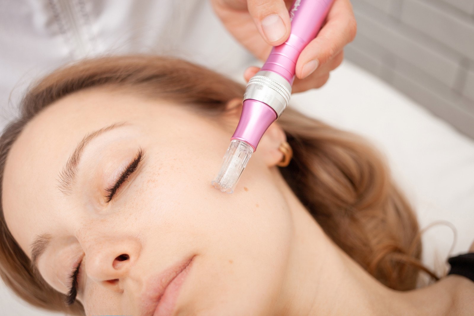 연어주사(Salmon Injection): 피부 재생과 탄력을 위한 주사 시술