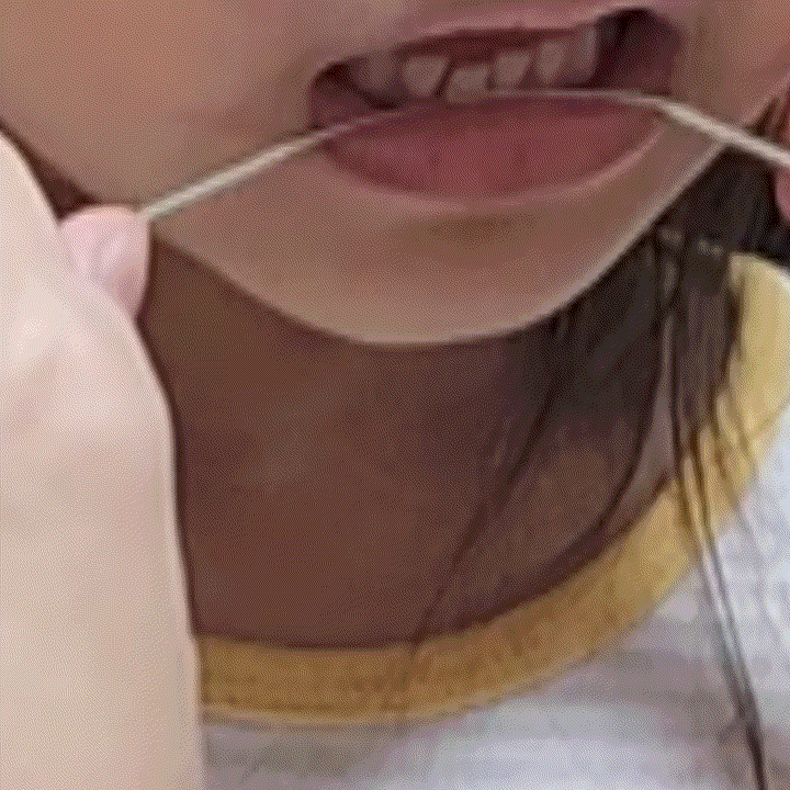 안아프게이빨뽑기