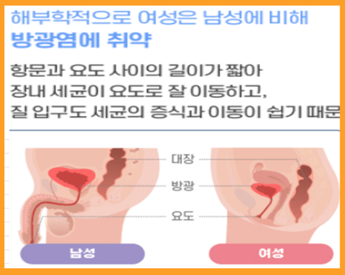 소변이-자주-마려운-증상