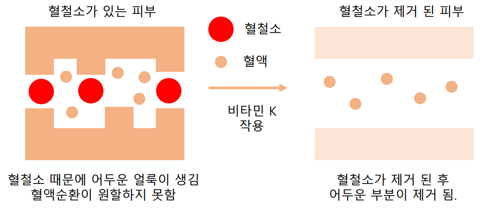 멍크림